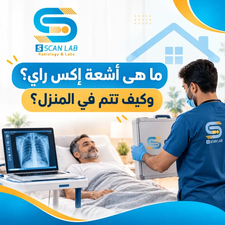 ما هي أشعة إكس راي؟ وكيف تتم في المنزل؟