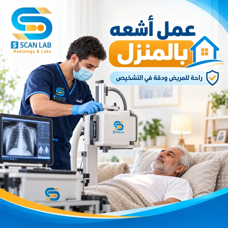 عمل أشعه بالمنزل