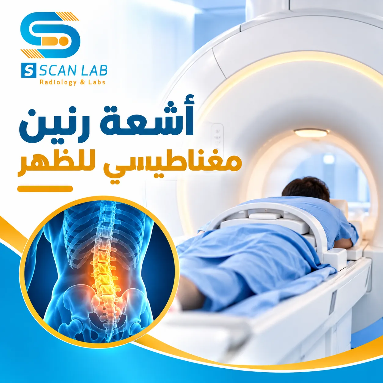 أشعة رنين مغناطيسي للظهر