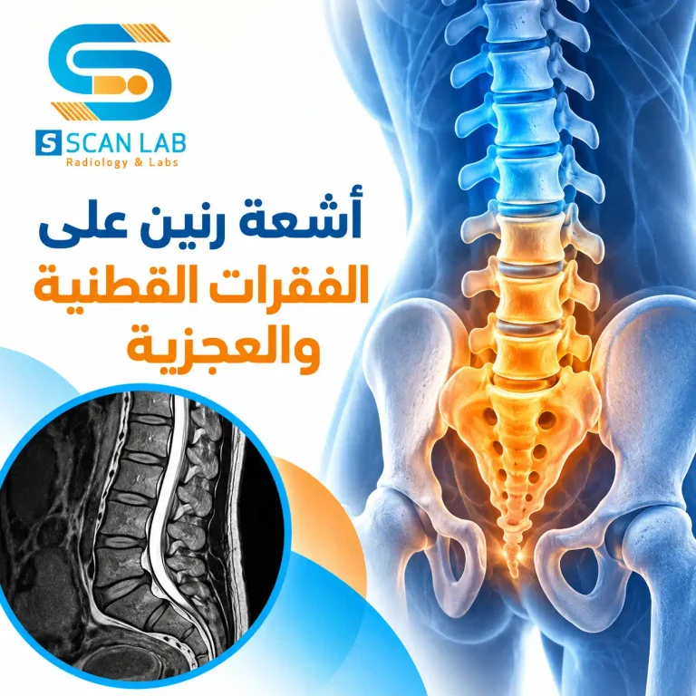 أشعة رنين على الفقرات القطنية والعجزية: السعر وقراءة النتيجة