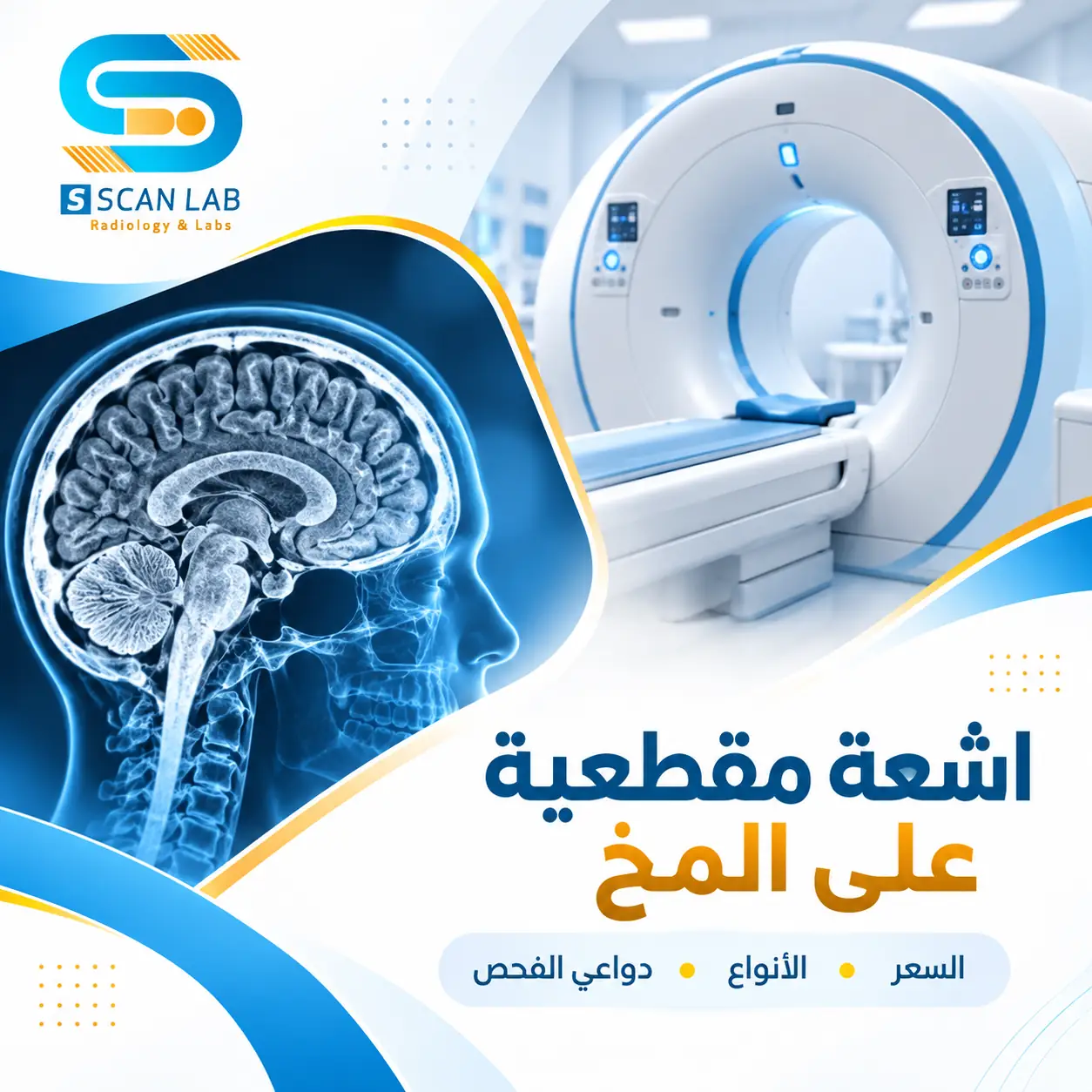 اشعة مقطعية على المخ