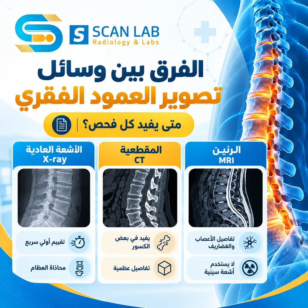 الفرق بين الرنين المغناطيسي والأشعة المقطعية والأشعة العادية على العمود الفقري.