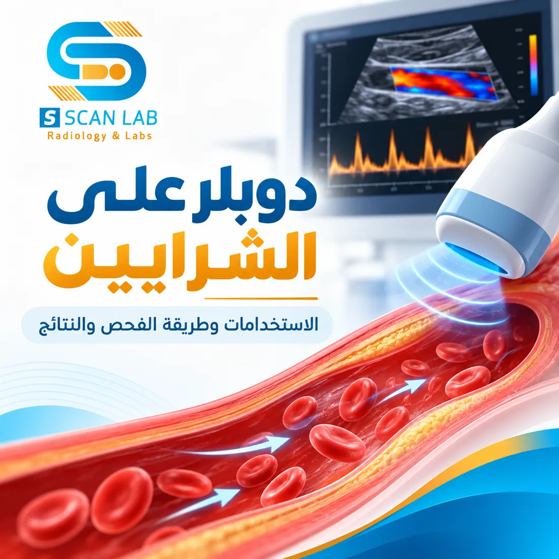 دوبلر على الشرايين