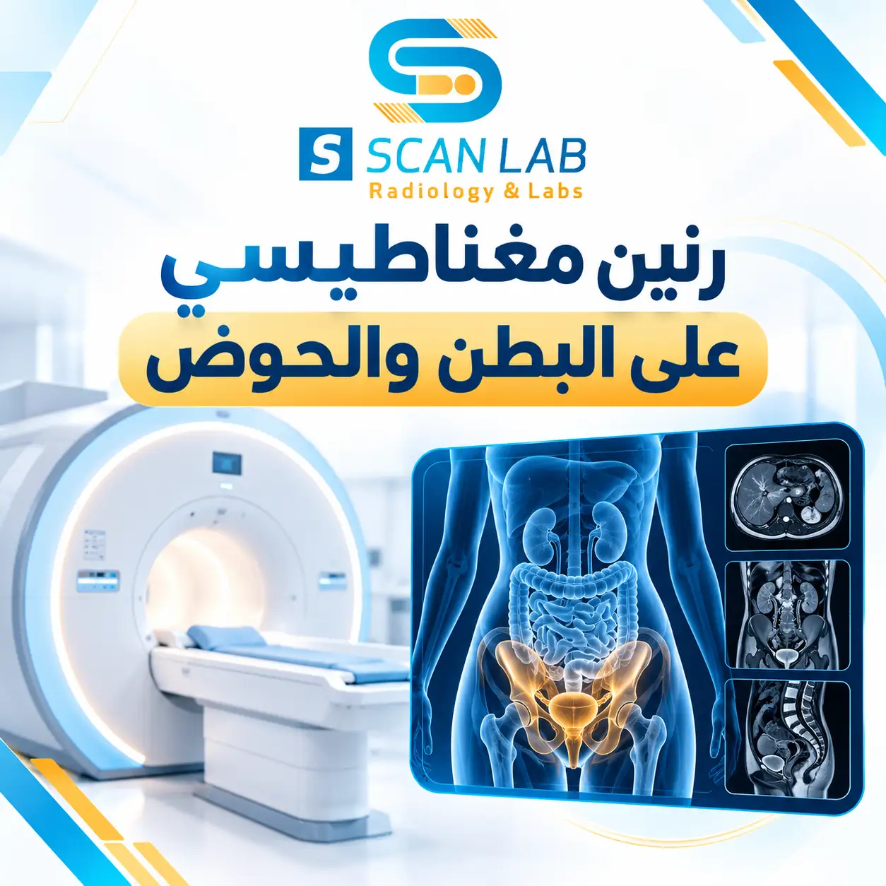 رنين مغناطيسي على البطن والحوض